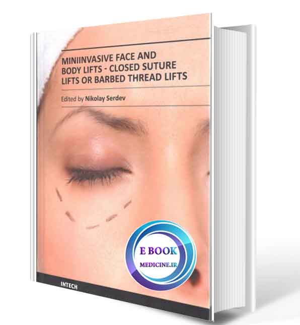 دانلود کتاب miniinvasive face and body lifts. ( ORIGINAL PDF)